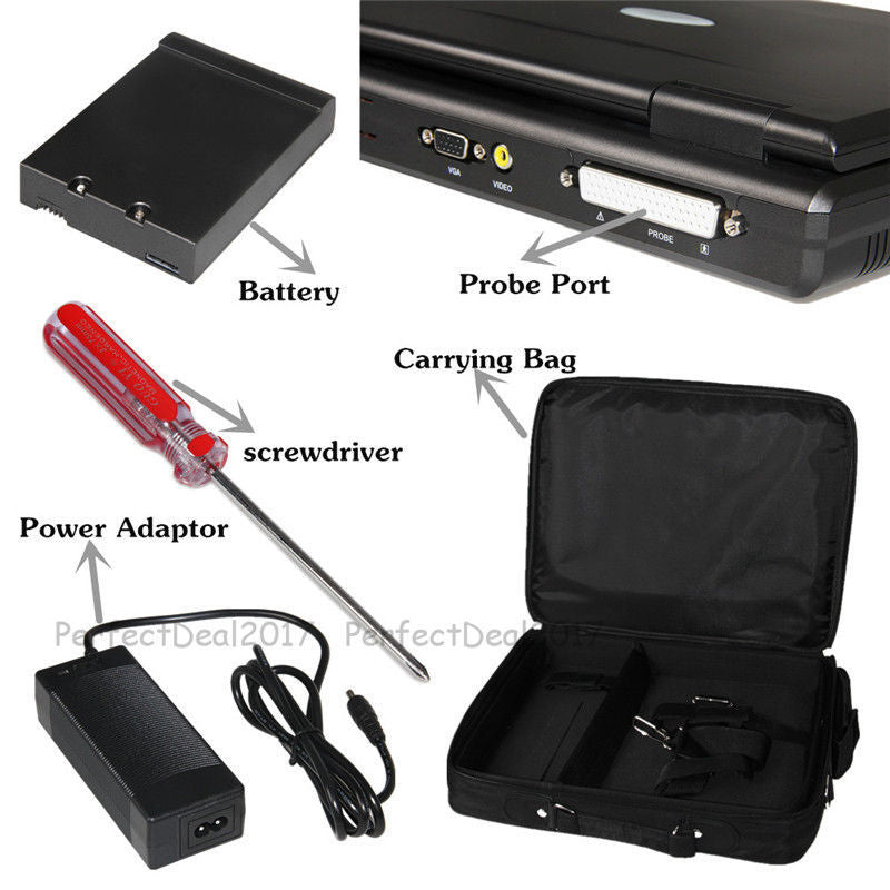 Portable Ultrasound Scanner Laptop Digital Diagnostic Machine 3.5 Convex Probe