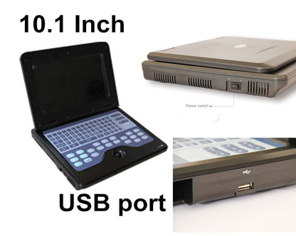 Portable Ultrasound Scanner Laptop Digital Diagnostic Machine 3.5 Convex Probe